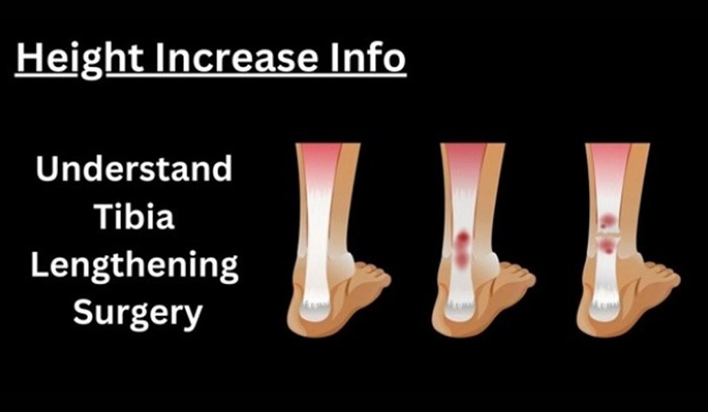 Tibia Lengthening Surgery